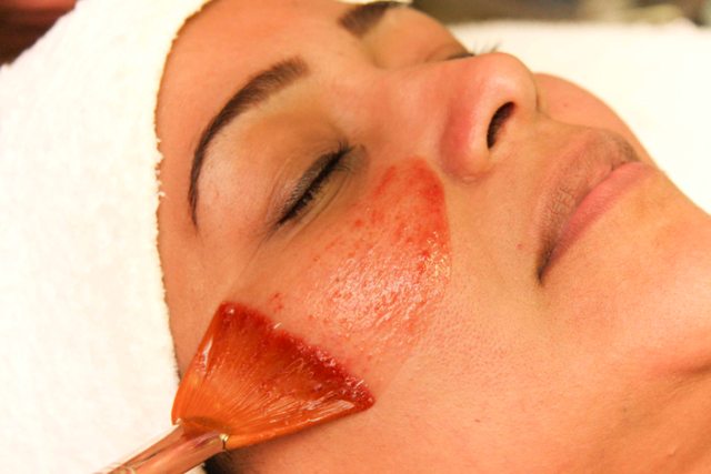 Peelings En El Verano