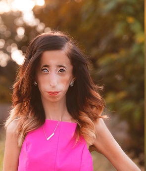 LizzieVelasquez_wireNOLOGO