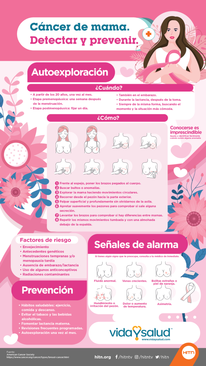 . Cuando se diagnostica el cáncer de seno en mujeres hispanas, los casos tienden a ser más avanzados y agresivos.